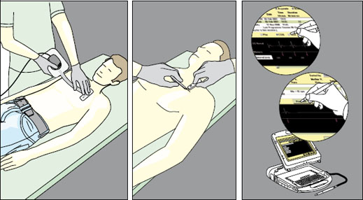Easy and efficient, from implant to follow-up