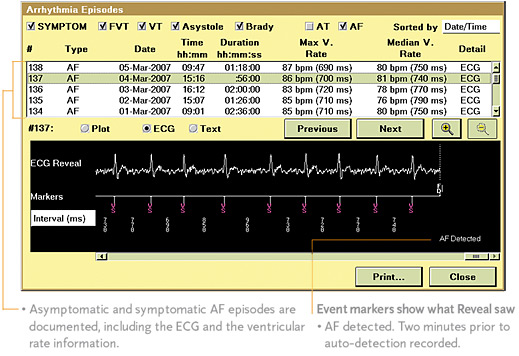 Screenshot of the Reveal interface