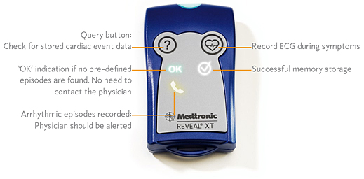 Screenshot of the Reveal interface
