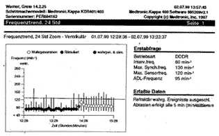 Medtronic