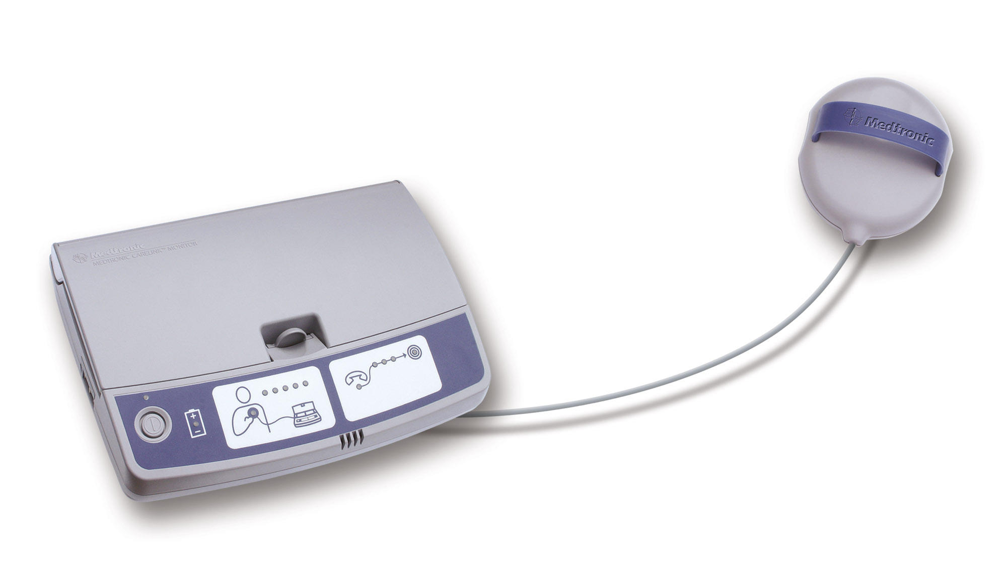 Pacemaker monitor and the NBN “NBN”