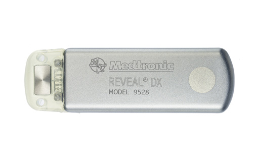Medtronics Reveal DX - Implantable Cardiac Monitor
