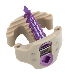 Medtronic Introduces the PEEK