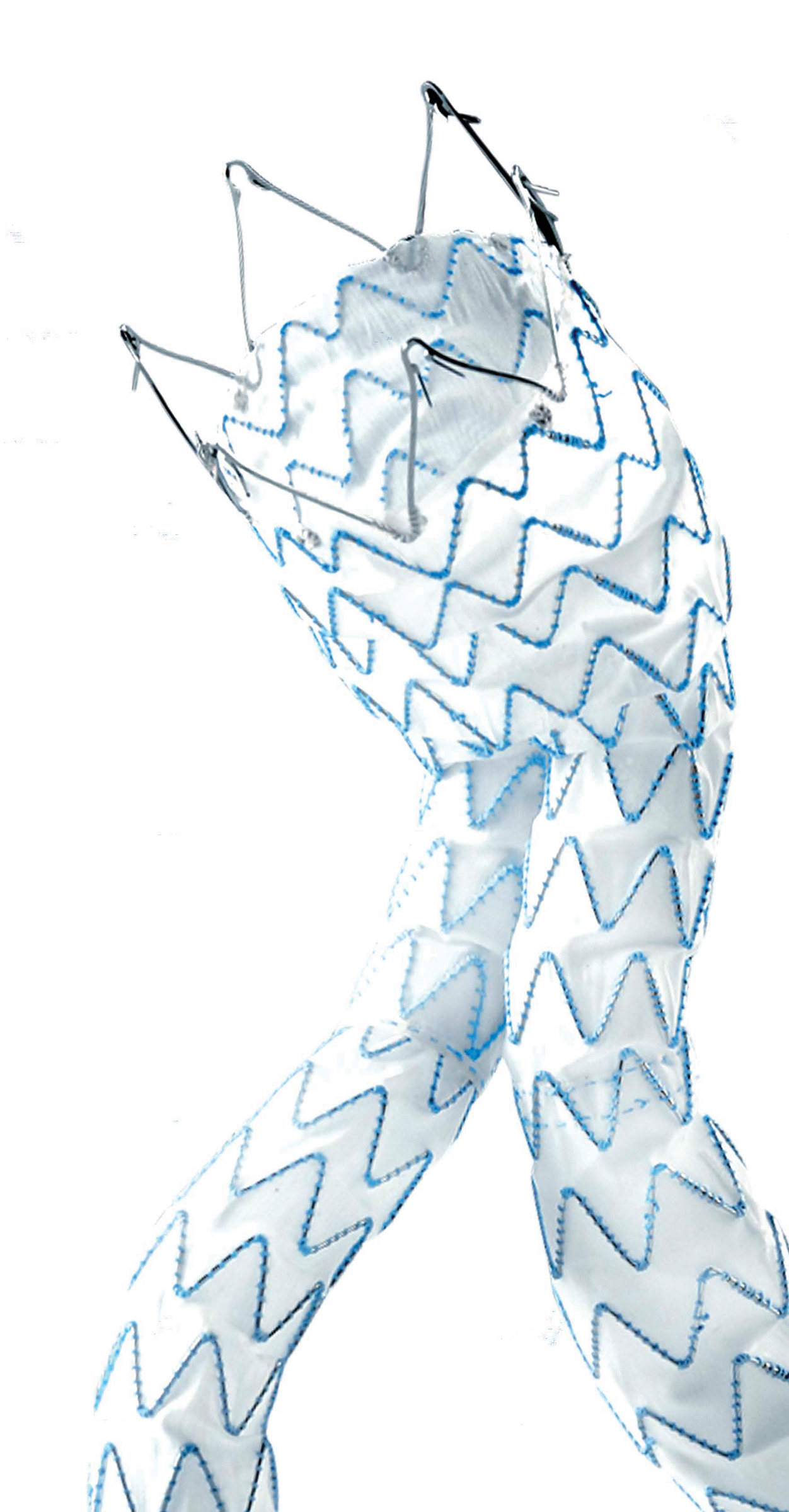 Aaa Stent Graft
