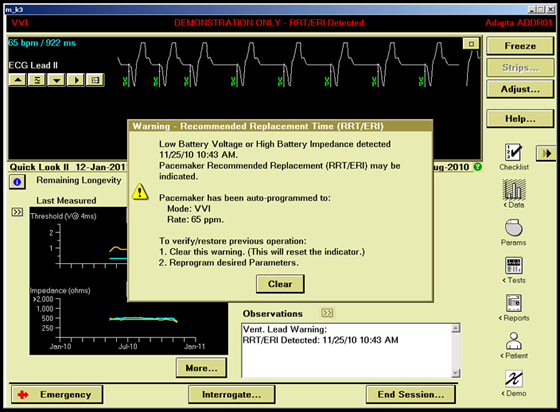 Meas Lock ERI Example 1 Image 1