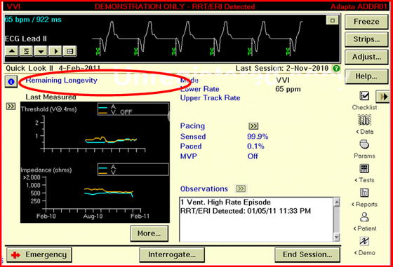 Meas Lock ERI Example 2 Image 1